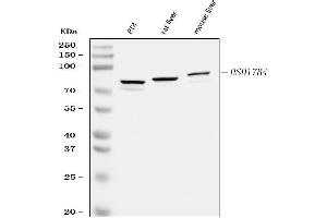anti-Hydroxysteroid (17-Beta) Dehydrogenase 4 (HSD17B4) (AA 510-736) antibody