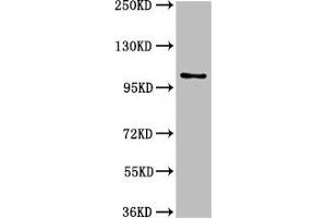 Western Blot Positive WB detected in: U87 whole cell lysate All lanes: AMPD2 antibody at 3 μg/mL Secondary Goat polyclonal to rabbit IgG at 1/50000 dilution Predicted band size: 101, 93, 89 kDa Observed band size: 101 kDa (AMPD2 anticorps  (AA 1-129))