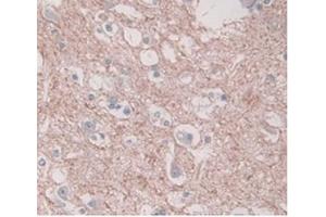 DAB staining on IHC-P; Samples:Human Brain Tissue)