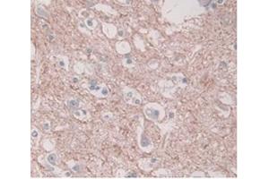 DAB staining on IHC-P; Samples:Human Brain Tissue) (PAI1 anticorps  (AA 25-402))