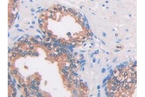 Detection of IDH1 in Human Prostate Tissue using Monoclonal Antibody to Isocitrate Dehydrogenase 1, Soluble (IDH1) (IDH1 anticorps  (AA 74-333))