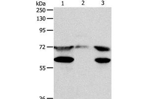 Western Blot analysis of Hela cell, Mouse testis tissue and Jurkat cell using CCDC99 Polyclonal Antibody at dilution of 1:400 (CCDC99 anticorps)