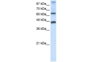 WB Suggested Anti-ZNF79 Antibody Titration:  0. (ZNF79 anticorps  (N-Term))