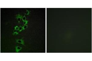 Immunofluorescence analysis of HepG2 cells, using HER4 (Ab-1284) Antibody. (ERBB4 anticorps  (AA 1250-1299))
