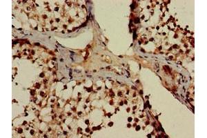 Immunohistochemistry of paraffin-embedded human testis tissue using ABIN7164998 at dilution of 1:100 (POT1 anticorps  (AA 250-432))