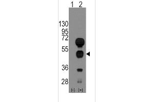 Western blot analysis of GATA4 using rabbit polyclonal GATA4 Antibody using 293 cell lysates (2 ug/lane) either nontransfected (Lane 1) or transiently transfected with the GATA4 gene (Lane 2).