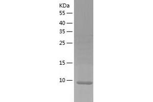 Organic Solute Transporter beta (OSTBETA) (AA 57-128) protein (His-IF2DI Tag)