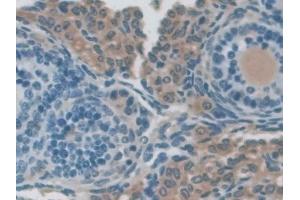 Detection of NXN in Mouse Ovary Tissue using Polyclonal Antibody to Nucleoredoxin (NXN)