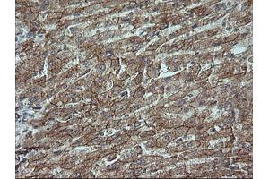 Image no. 6 for anti-Catenin (Cadherin-Associated Protein), beta 1, 88kDa (CTNNB1) antibody (ABIN1496898)