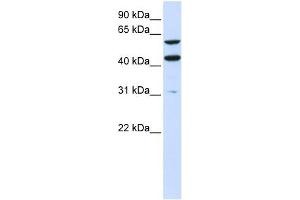 PTDSS1 antibody used at 1 ug/ml to detect target protein.