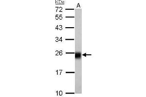 WB Image NDUFS8 antibody detects NDUFS8 protein by Western blot analysis.
