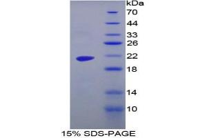 SDS-PAGE analysis of Human MGA Protein. (AGLU Protéine)