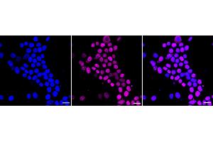 Immunocytochemical staining of HeLa cells with ISL1 antibody (ABIN7799130), 1:1,000). (Recombinant ISL1 anticorps)