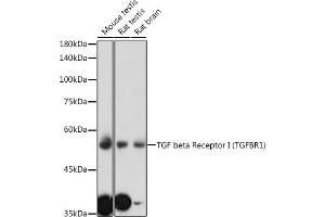 Western blot analysis of extracts of various cell lines, using TGF beta Receptor I (TGF beta Receptor I (TGFBR1)) antibody (ABIN6130733, ABIN6149081, ABIN6149082 and ABIN6213963) at 1:1000 dilution. (TGFBR1 anticorps  (AA 34-124))