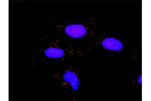 Proximity Ligation Analysis of protein-protein interactions between MMP2 and A2M.