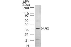 Western Blotting (WB) image for anti-Death-Associated Protein Kinase 2 (DAPK2) (AA 325-342) antibody (ABIN208411) (DAPK2 anticorps  (AA 325-342))