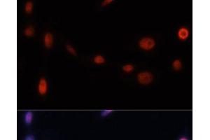 Immunofluorescence analysis of NIH/3T3 cells using p21 Polyclonal Antibody at dilution of 1:100. (p21 anticorps)