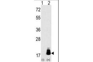 Western blot analysis of EIF4EBP1 (arrow) using rabbit polyclonal EIF4EBP1 Antibody (T69) (R). (eIF4EBP1 anticorps  (AA 48-77))