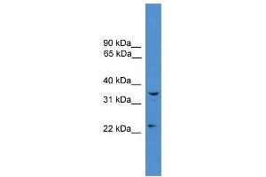 WB Suggested Anti-UCHL5 Antibody Titration: 0. (UCHL5 anticorps  (Middle Region))