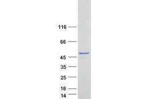 Validation with Western Blot