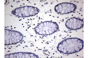 Image no. 3 for anti-TIA1 Cytotoxic Granule-Associated RNA Binding Protein (TIA1) antibody (ABIN1501387) (TIA1 anticorps)