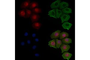 ABIN6257069 and ABIN6274978 staining Hela cells by IF/ICC.