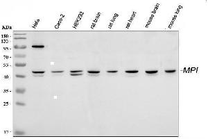 Western blot analysis of MPI using anti-MPI antibody (ABIN4886672). (MPI anticorps  (AA 2-99))