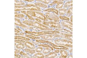 Immunohistochemistry of paraffin-embedded mouse kidney using [KO Validated] SIRT3 Rabbit mAb (ABIN7270324) at dilution of 1:100 (40x lens).