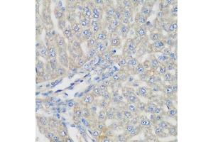 Immunohistochemistry of paraffin-embedded rat liver using METTL7A antibody (ABIN5974519) at dilution of 1/200 (40x lens). (METTL7A anticorps)