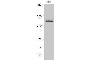 Western Blotting (WB) image for anti-Tyrosine Kinase 2 (TYK2) (Tyr260) antibody (ABIN3177844) (TYK2 anticorps  (Tyr260))