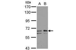 Image no. 2 for anti-UDP-N-Acetyl-alpha-D-Galactosamine:polypeptide N-Acetylgalactosaminyltransferase 2 (GalNAc-T2) (GALNT2) (AA 272-523) antibody (ABIN1498370) (GALNT2 anticorps  (AA 272-523))