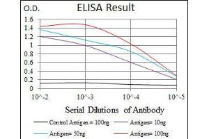 Black line: Control Antigen (100 ng), Purple line: Antigen(10 ng), Blue line: Antigen (50 ng), Red line: Antigen (100 ng), (LPA anticorps  (AA 4330-4521))