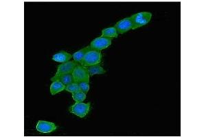 IF analysis of RAB5A using anti-RAB5A antibody (ABIN6719366).