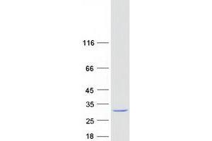 Validation with Western Blot