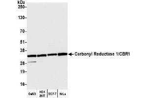 Western Blotting (WB) image for anti-Carbonyl Reductase 1 (CBR1) (AA 227-277) antibody (ABIN7450066)