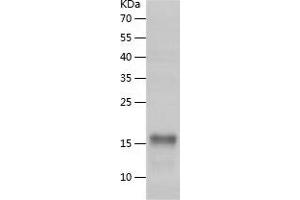 Western Blotting (WB) image for Receptor tyrosine-protein kinase erbB-2 (ErbB2/Her2) (AA 511-630) protein (His tag) (ABIN7124801)