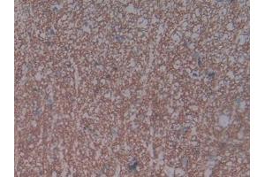 Detection of NPR3 in Rat Spinal cord Tissue using Polyclonal Antibody to Natriuretic Peptide Receptor 3 (NPR3) (NPR3 anticorps  (AA 45-467))