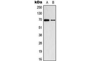 Western blot analysis of ADCK2 expression in K562 (A), VEC (B) whole cell lysates. (ADCK2 anticorps  (Center))