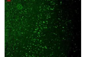 Immunohistochemistry analysis using Mouse Anti-TrpM7 Monoclonal Antibody, Clone S74 (ABIN361775).