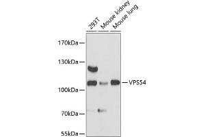 Western blot analysis of extracts of various cell lines, using VPS54 antibody (ABIN6133042, ABIN6150144, ABIN6150145 and ABIN6217132) at 1:3000 dilution.