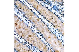 Immunohistochemistry of paraffin embedded human colon using FCGBP (ABIN7073926) at dilution of 1:800 (250x lens) (FCGBP anticorps)