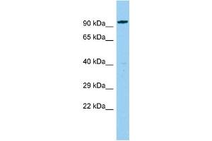 Host: Rabbit Target Name: CEP85L Sample Type: Fetal Liver lysates Antibody Dilution: 1.