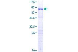 Image no. 1 for G Kinase Anchoring Protein 1 (GKAP1) (AA 1-366) protein (GST tag) (ABIN1355168)