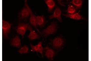 ABIN6272445 staining RAW264. (ZFP36L1 anticorps  (Internal Region))