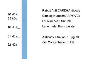 WB Suggested Anti-CARD9  Antibody Titration: 0. (CARD9 anticorps  (Middle Region))