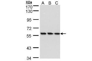 WB Image Sample (30 ug of whole cell lysate) A: HeLa B: Hep G2 , C: MOLT4 , 7. (RNGTT anticorps)