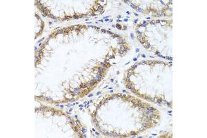 Immunohistochemistry of paraffin-embedded human stomach using GPM6A antibody (ABIN6134764, ABIN6141338, ABIN6141340 and ABIN6224880) at dilution of 1:100 (40x lens). (GPM6A anticorps  (AA 1-100))