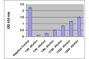 8-OHdG Levels in Human Urine.