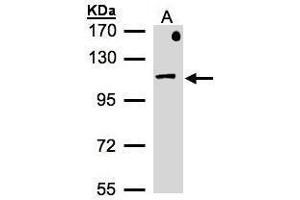 anti-Adaptor-Related Protein Complex 2, beta 1 Subunit (AP2B1) (Internal Region) antibody