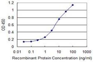 Detection limit for recombinant GST tagged PATZ1 is 0. (PATZ1 anticorps  (AA 260-358))